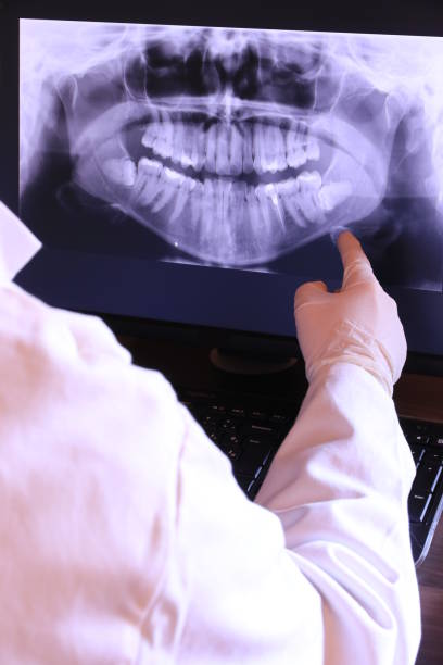 Best Emergency Broken Tooth Repair in Richland, MO