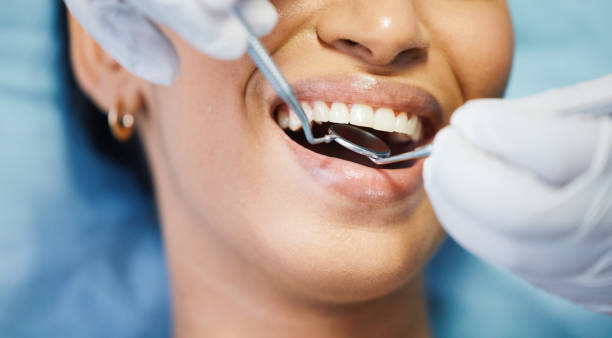Best Emergency Wisdom Teeth Removal in Richland, MO