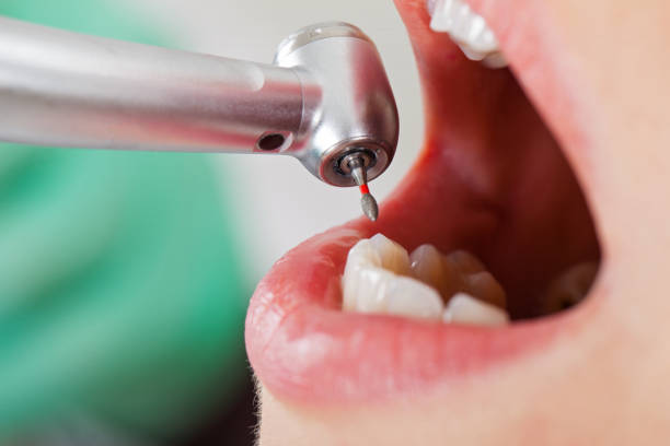 Best Weekend Emergency Dentist in Richland, MO